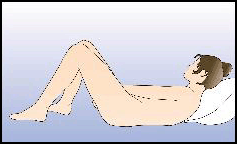 Nuvaring sistema de liberacion vaginal-figura4